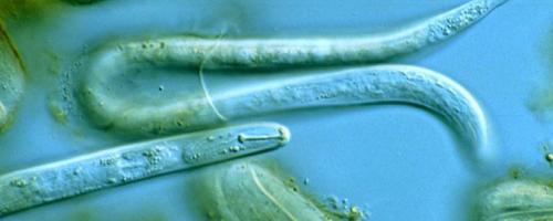 potato cyst nematode (Globodera rostochiensis), second stage juveniles and eggs