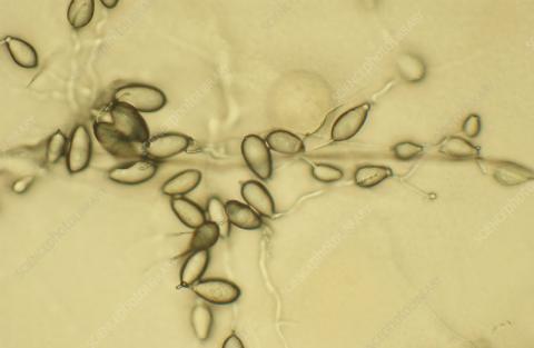 Phytophthora ramorum sporangia. Phytophthora ramorum sporangia. Credit Science photo library
