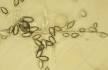 Phytophthora ramorum sporangia. Phytophthora ramorum sporangia. Credit Science photo library